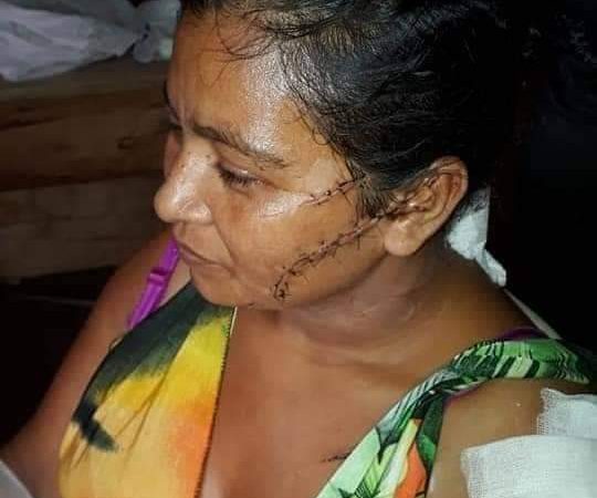 Hombre intenta asesinar a su pareja  en Nueva Guinea Managua/Radio La Primerísima
