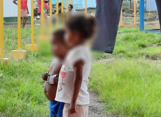 Tres niños intoxicados tras consumir bananos envenenados en Siuna Managua. Radio La Primerísima