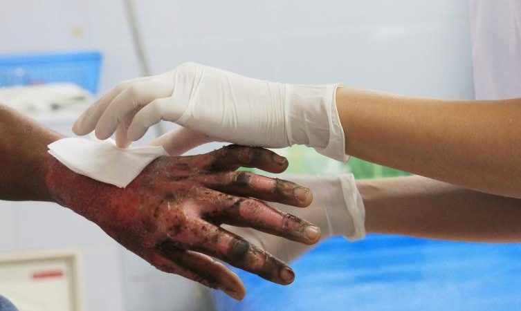 Van 25 personas lesionadas con pólvora en diciembre Managua. Radio La Primerísima