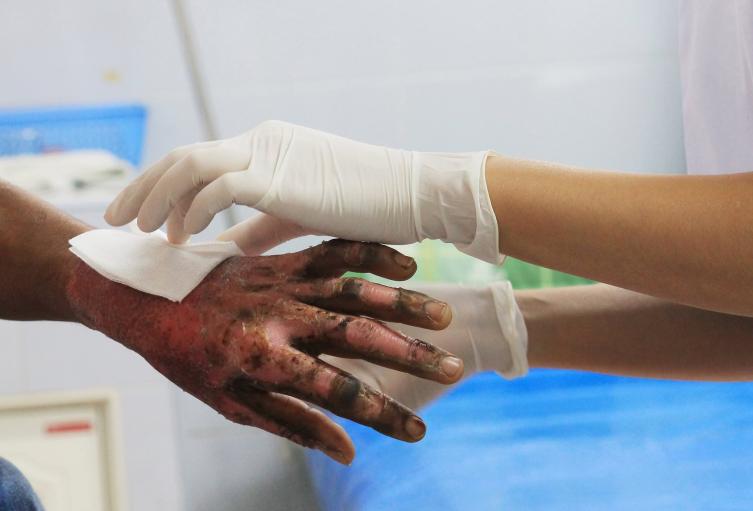 Van 25 personas lesionadas con pólvora en diciembre Managua. Radio La Primerísima