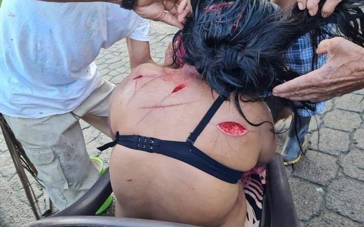 Mujer sobrevive a brutal agresión en Nueva Guinea Managua. Radio La Primerísima