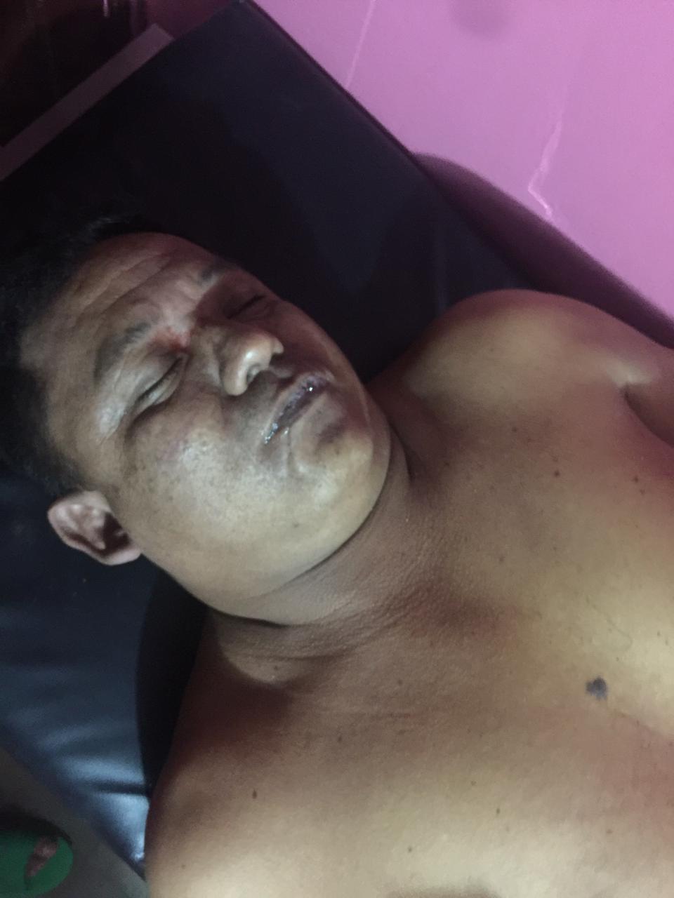 Asesinan a hombre en un bar de Waslala Managua. Radio La Primerísima /Jerson Dumas 