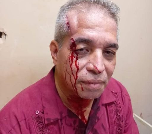 Sujetos agreden a reverendo por robarle su celular dentro de hospital Managua. Radio La Primerísima 