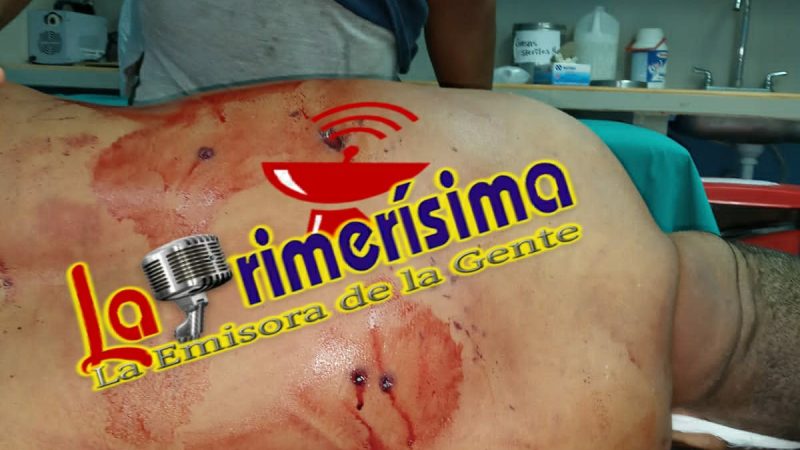 Asesinan a balazos a un hombre en El Tortuguero Managua. Alexander Hurtado/ La Primerísima